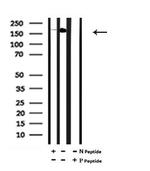 Phospho-FANCA (Ser1449) Antibody in Western Blot (WB)