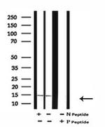 Phospho-Survivin (Thr48) Antibody in Western Blot (WB)