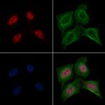 Phospho-PDPK1 (Thr245) Antibody in Immunocytochemistry (ICC/IF)