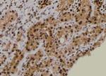 Phospho-PDPK1 (Thr245) Antibody in Immunohistochemistry (Paraffin) (IHC (P))