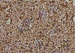 Phospho-PDPK1 (Thr245) Antibody in Immunohistochemistry (Paraffin) (IHC (P))