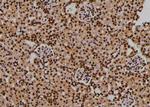 Phospho-PDPK1 (Thr245) Antibody in Immunohistochemistry (Paraffin) (IHC (P))