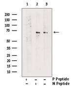 Phospho-PDPK1 (Thr245) Antibody in Western Blot (WB)