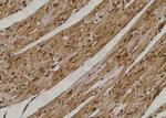 Phospho-TAK1 (Ser192) Antibody in Immunohistochemistry (Paraffin) (IHC (P))