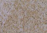 Phospho-RIP2 (Ser531) Antibody in Immunohistochemistry (Paraffin) (IHC (P))