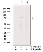 Phospho-RIP2 (Ser531) Antibody in Western Blot (WB)