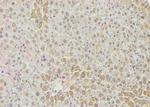 Phospho-Bim (Ser118) Antibody in Immunohistochemistry (Paraffin) (IHC (P))