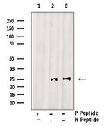 Phospho-Bim (Ser118) Antibody in Western Blot (WB)