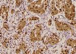 Phospho-FoxO3a (Ser644) Antibody in Immunohistochemistry (Paraffin) (IHC (P))