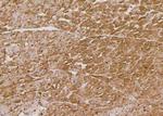 Phospho-FoxO3a (Ser644) Antibody in Immunohistochemistry (Paraffin) (IHC (P))