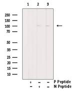 Phospho-FoxO3a (Ser644) Antibody in Western Blot (WB)