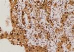 Phospho-LAT (Tyr45) Antibody in Immunohistochemistry (Paraffin) (IHC (P))