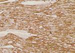 Phospho-LAT (Tyr45) Antibody in Immunohistochemistry (Paraffin) (IHC (P))