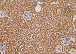 Phospho-AS160 (Ser341) Antibody in Immunohistochemistry (Paraffin) (IHC (P))