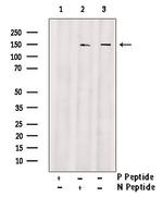 Phospho-AS160 (Ser341) Antibody in Western Blot (WB)