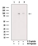 Phospho-TLR5 (Ser805) Antibody in Western Blot (WB)