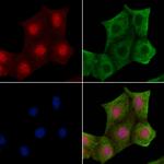 Phospho-delta Catenin (Tyr280) Antibody in Immunocytochemistry (ICC/IF)