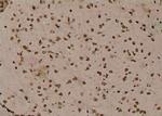 Phospho-delta Catenin (Tyr280) Antibody in Immunohistochemistry (Paraffin) (IHC (P))