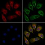 Phospho-delta Catenin (Tyr96) Antibody in Immunocytochemistry (ICC/IF)