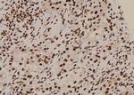 Phospho-delta Catenin (Tyr96) Antibody in Immunohistochemistry (Paraffin) (IHC (P))