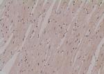 Phospho-PFKFB2 (Ser32) Antibody in Immunohistochemistry (Paraffin) (IHC (P))