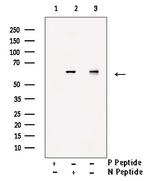 Phospho-PFKFB2 (Ser32) Antibody in Western Blot (WB)