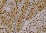 Phospho-NBS1 (Ser432) Antibody in Immunohistochemistry (Paraffin) (IHC (P))