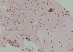 Phospho-NBS1 (Ser432) Antibody in Immunohistochemistry (Paraffin) (IHC (P))