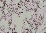 Phospho-NBS1 (Ser432) Antibody in Immunohistochemistry (Paraffin) (IHC (P))