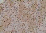 Phospho-ROCK2 (Ser1379) Antibody in Immunohistochemistry (Paraffin) (IHC (P))