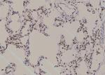 Phospho-ROCK2 (Ser1379) Antibody in Immunohistochemistry (Paraffin) (IHC (P))