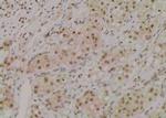 Phospho-ROCK2 (Ser1366) Antibody in Immunohistochemistry (Paraffin) (IHC (P))