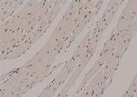 Phospho-ROCK2 (Ser1366) Antibody in Immunohistochemistry (Paraffin) (IHC (P))