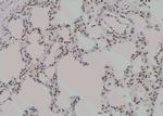 Phospho-ROCK2 (Ser1366) Antibody in Immunohistochemistry (Paraffin) (IHC (P))