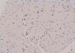 Phospho-ULK1 (Ser450) Antibody in Immunohistochemistry (Paraffin) (IHC (P))