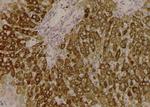 Phospho-ULK1 (Ser450) Antibody in Immunohistochemistry (Paraffin) (IHC (P))