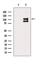 Phospho-ULK1 (Ser450) Antibody in Western Blot (WB)