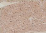 Phospho-ULK1 (Ser556) Antibody in Immunohistochemistry (Paraffin) (IHC (P))