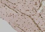 Phospho-IRE1 alpha (Tyr628) Antibody in Immunohistochemistry (Paraffin) (IHC (P))