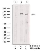 Phospho-IRE1 alpha (Tyr628) Antibody in Western Blot (WB)