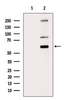 Phospho-DAB1 (Tyr198) Antibody in Western Blot (WB)