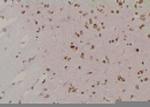 Phospho-LATS1 (Tyr283) Antibody in Immunohistochemistry (Paraffin) (IHC (P))