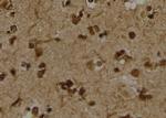 Phospho-LDHA (Tyr239) Antibody in Immunohistochemistry (Paraffin) (IHC (P))