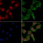 Phospho-Lamin A/C (Ser301) Antibody in Immunocytochemistry (ICC/IF)