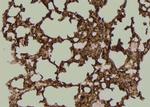 Phospho-TK1 (Tyr181) Antibody in Immunohistochemistry (Paraffin) (IHC (P))