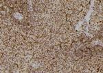 Phospho-TK1 (Tyr181) Antibody in Immunohistochemistry (Paraffin) (IHC (P))