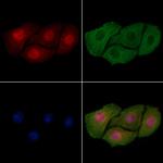 Phospho-ErbB2 (HER-2) (Tyr735) Antibody in Immunocytochemistry (ICC/IF)