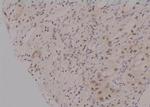 Phospho-ErbB2 (HER-2) (Tyr735) Antibody in Immunohistochemistry (Paraffin) (IHC (P))