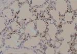 Phospho-ErbB2 (HER-2) (Tyr735) Antibody in Immunohistochemistry (Paraffin) (IHC (P))