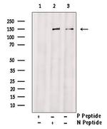 Phospho-ErbB2 (HER-2) (Tyr735) Antibody in Western Blot (WB)